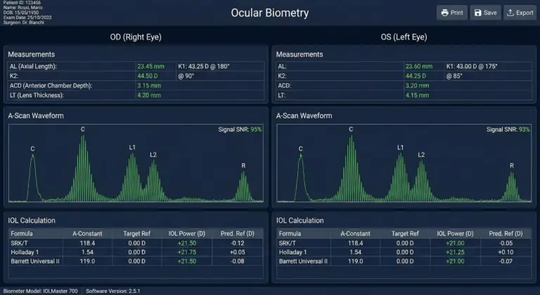 Illustrazione delle misurazioni biometriche dell’occhio