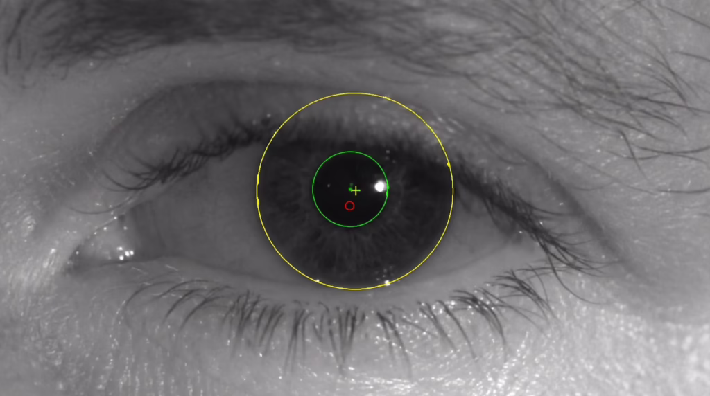 Esame fondo oculare visita oculistica Roma