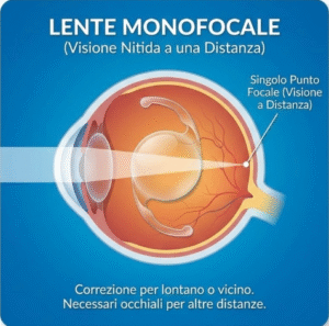lente monofocale